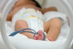 Premature newborn  baby girl